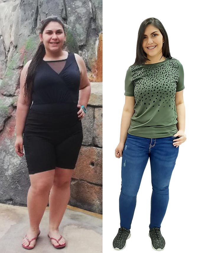 Clínicas para Lipólisis de Alta Definición en Bogotá, Colombia